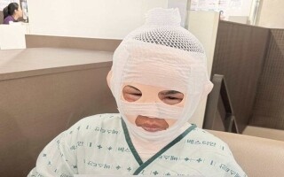 Seoul Man Pours Boiling Water on Partner's Face